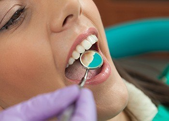Closeup of patient during dental exam