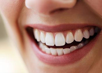 Closeup of healthy teeth and gums