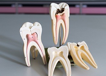 Model of inside of tooth