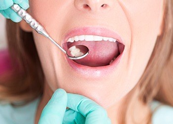 Closeup of patient during dental treatment