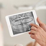 Digital dental x-rays on tablet computer